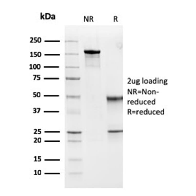 SDS-PAGE - Anti-MSH6 Antibody [MSH6/3091] - BSA and Azide free (A251960) - Antibodies.com