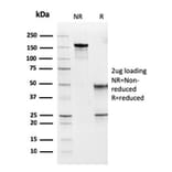 SDS-PAGE - Anti-MSH6 Antibody [MSH6/3091] - BSA and Azide free (A251960) - Antibodies.com
