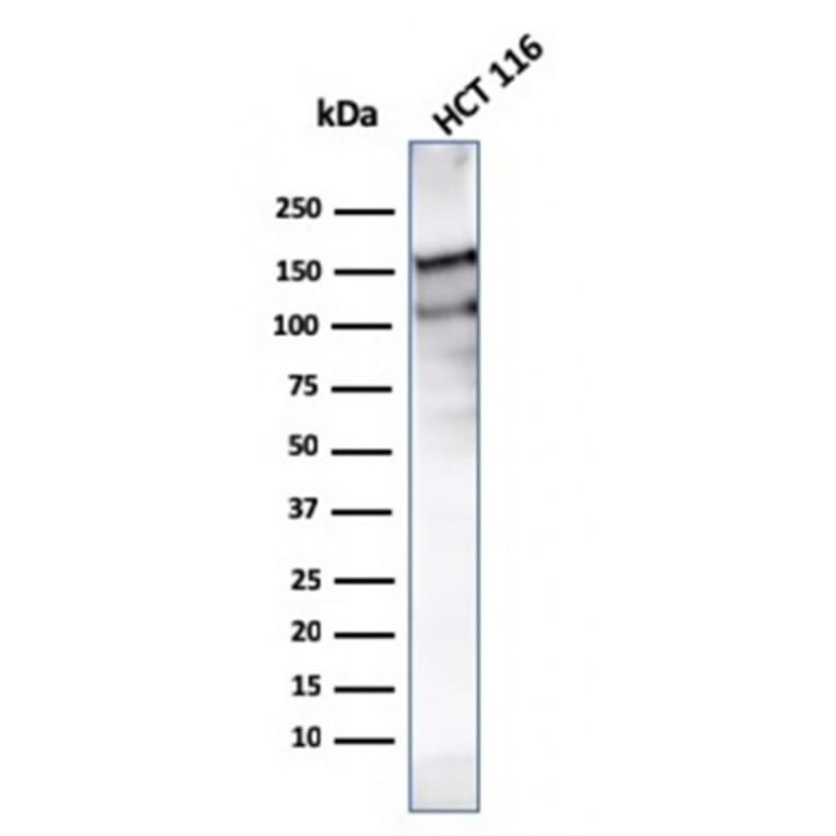 Western Blot - Anti-MSH6 Antibody [MSH6/3091] - BSA and Azide free (A251960) - Antibodies.com