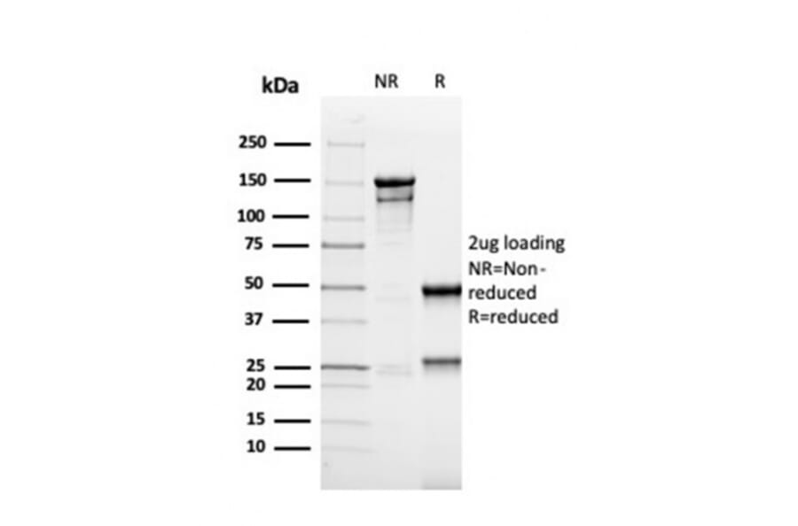 SDS-PAGE - Anti-MSH6 Antibody [rMSH6/4743] - BSA and Azide free (A251961) - Antibodies.com