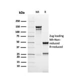 SDS-PAGE - Anti-MSH6 Antibody [rMSH6/4743] - BSA and Azide free (A251961) - Antibodies.com