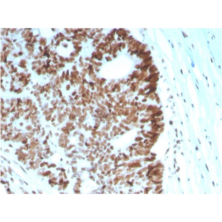 Immunohistochemistry - Anti-MSH6 Antibody [MSH6/2927] - BSA and Azide free (A251963) - Antibodies.com