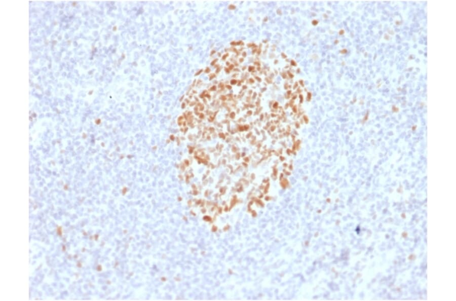 Immunohistochemistry - Anti-MSH6 Antibody [MSH6/2927] - BSA and Azide free (A251963) - Antibodies.com