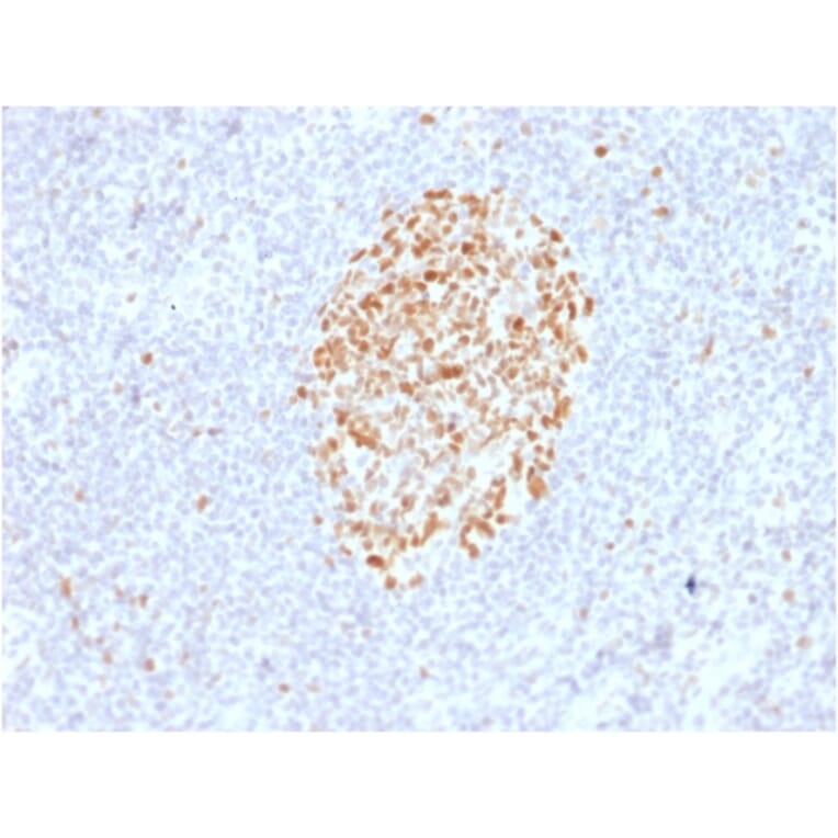 Immunohistochemistry - Anti-MSH6 Antibody [MSH6/2927] - BSA and Azide free (A251963) - Antibodies.com