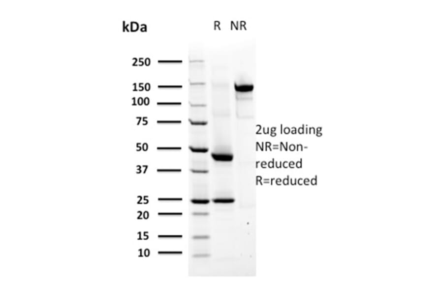 SDS-PAGE - Anti-MSH6 Antibody [MSH6/2927] - BSA and Azide free (A251963) - Antibodies.com