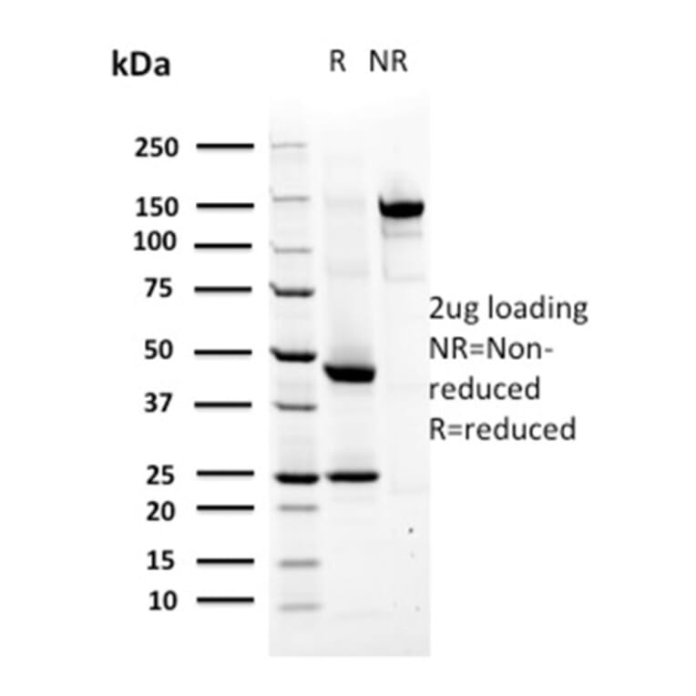 SDS-PAGE - Anti-MSH6 Antibody [MSH6/2927] - BSA and Azide free (A251963) - Antibodies.com
