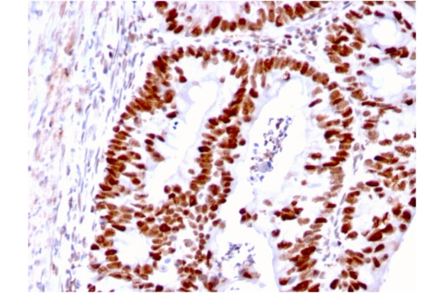 Immunohistochemistry - Anti-MSH6 Antibody [MSH6/3085] - BSA and Azide free (A251964) - Antibodies.com