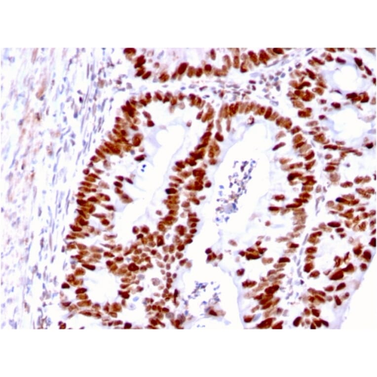 Immunohistochemistry - Anti-MSH6 Antibody [MSH6/3085] - BSA and Azide free (A251964) - Antibodies.com