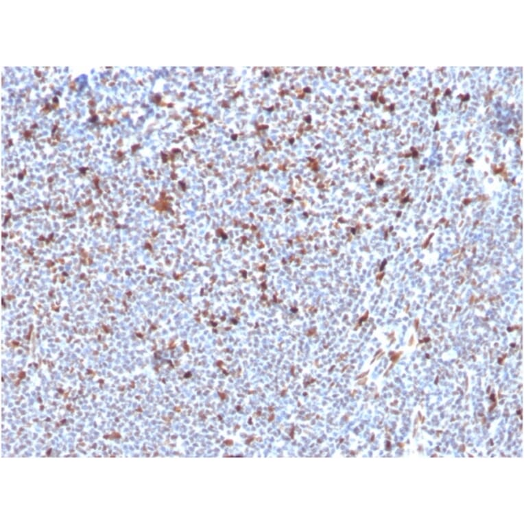 Immunohistochemistry - Anti-MSH6 Antibody [MSH6/3085] - BSA and Azide free (A251964) - Antibodies.com