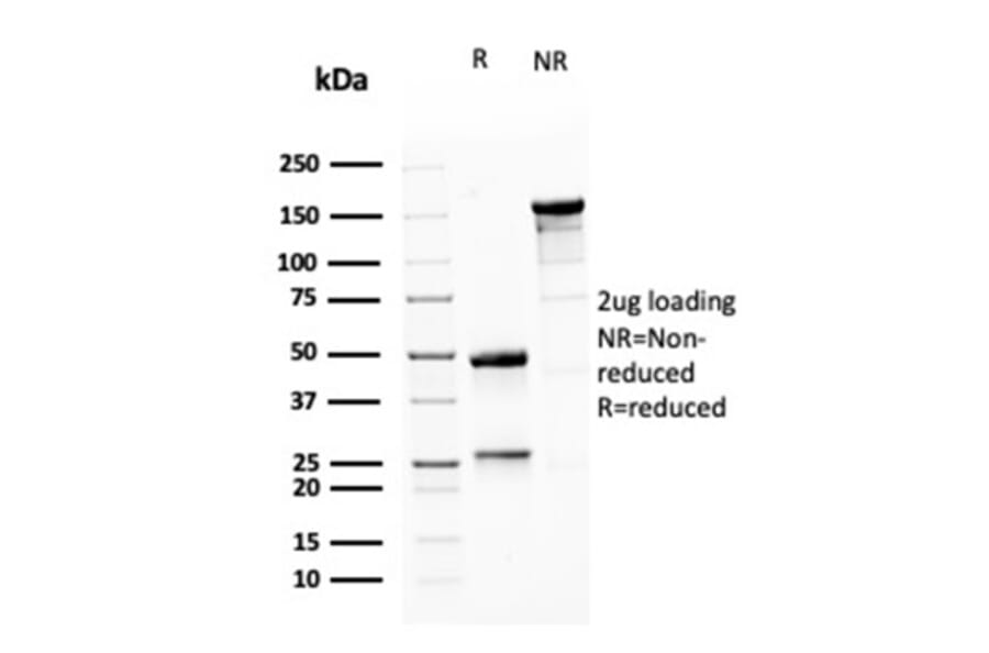 SDS-PAGE - Anti-MSH6 Antibody [MSH6/3085] - BSA and Azide free (A251964) - Antibodies.com