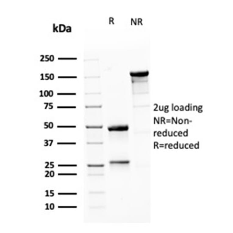 SDS-PAGE - Anti-MSH6 Antibody [MSH6/3085] - BSA and Azide free (A251964) - Antibodies.com