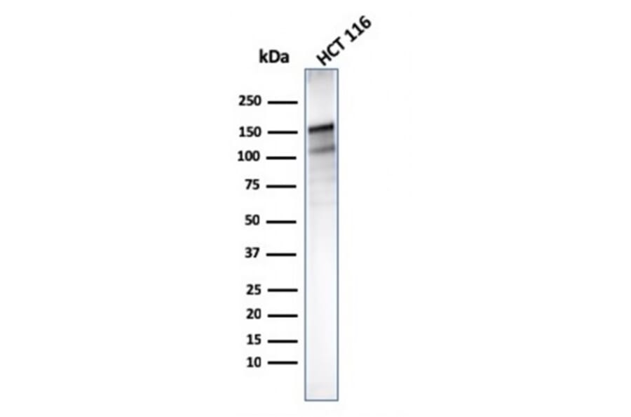 Western Blot - Anti-MSH6 Antibody [MSH6/3085] - BSA and Azide free (A251964) - Antibodies.com