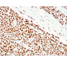 Immunohistochemistry - Anti-MSH6 Antibody [MSH6/3086] - BSA and Azide free (A251965) - Antibodies.com