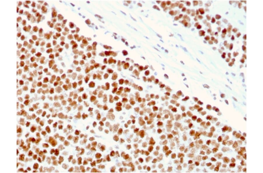 Immunohistochemistry - Anti-MSH6 Antibody [MSH6/3086] - BSA and Azide free (A251965) - Antibodies.com