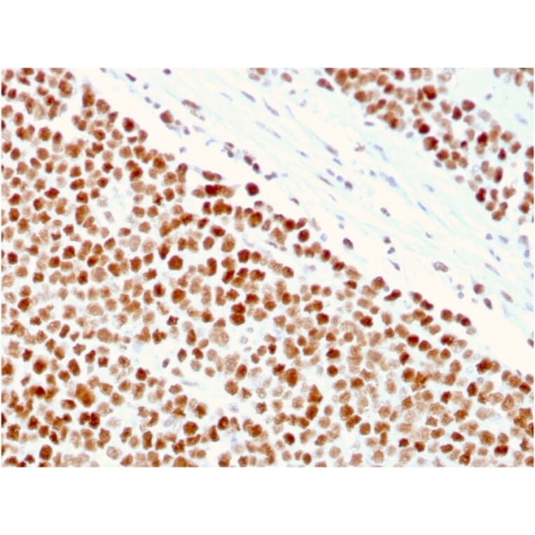 Immunohistochemistry - Anti-MSH6 Antibody [MSH6/3086] - BSA and Azide free (A251965) - Antibodies.com