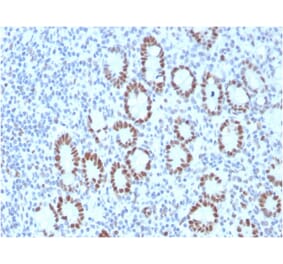 Immunohistochemistry - Anti-MSH6 Antibody [MSH6/3089] - BSA and Azide free (A251966) - Antibodies.com