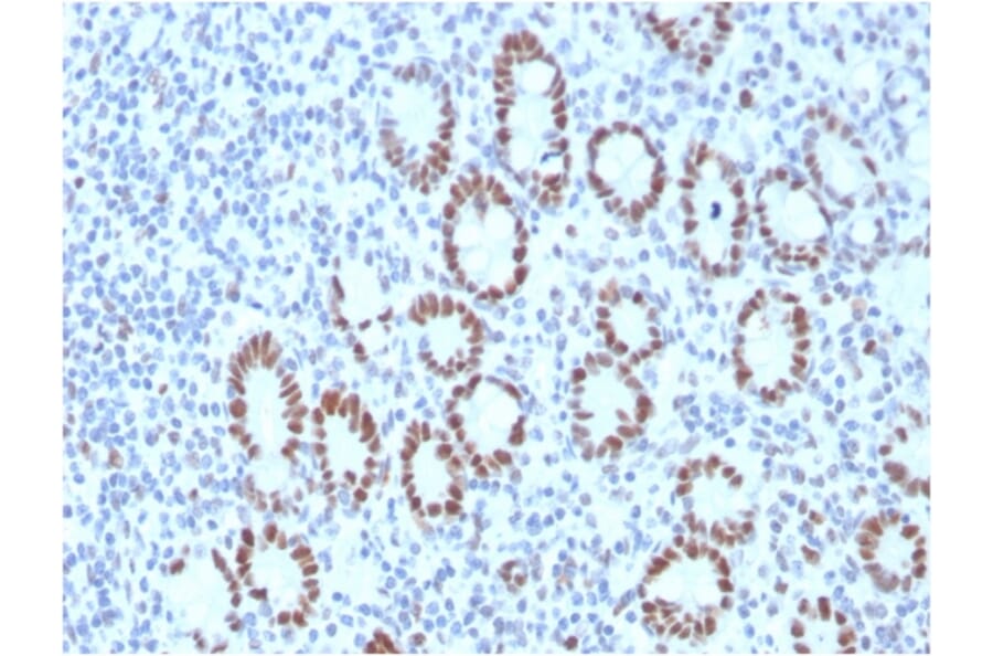 Immunohistochemistry - Anti-MSH6 Antibody [MSH6/3089] - BSA and Azide free (A251966) - Antibodies.com