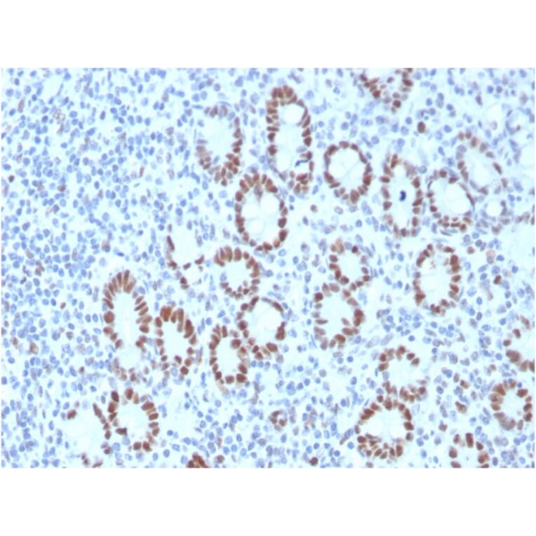 Immunohistochemistry - Anti-MSH6 Antibody [MSH6/3089] - BSA and Azide free (A251966) - Antibodies.com