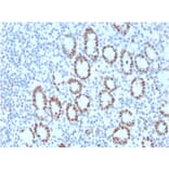 Immunohistochemistry - Anti-MSH6 Antibody [MSH6/3089] - BSA and Azide free (A251966) - Antibodies.com