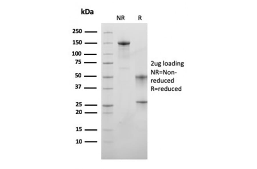 SDS-PAGE - Anti-MSH6 Antibody [MSH6/3089] - BSA and Azide free (A251966) - Antibodies.com