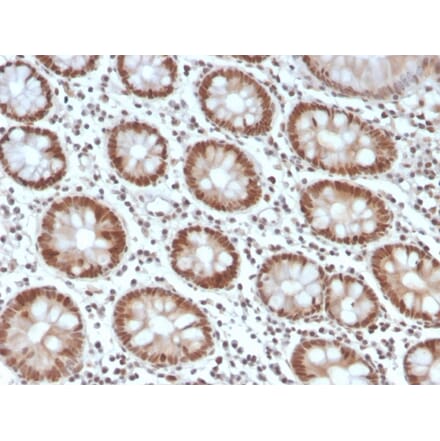 Immunohistochemistry - Anti-MSH6 Antibody [MSH6/4592R] - BSA and Azide free (A251966) - Antibodies.com