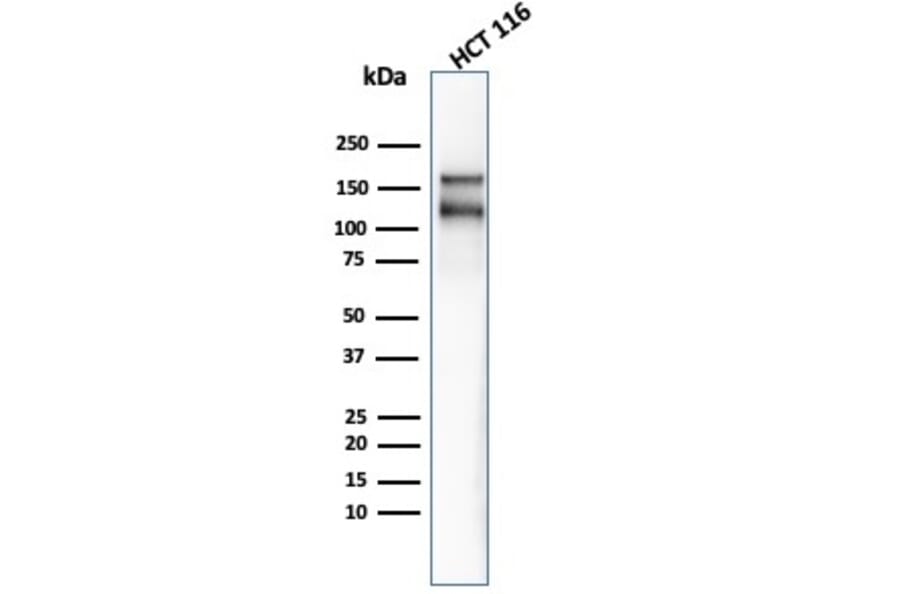 Western Blot - Anti-MSH6 Antibody [MSH6/4592R] - BSA and Azide free (A251967) - Antibodies.com