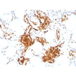 Immunohistochemistry - Anti-Glycophorin A Antibody [SPM599] - BSA and Azide free (A251969) - Antibodies.com