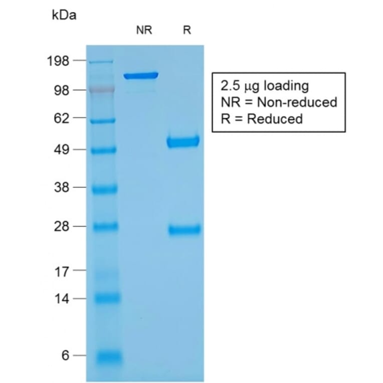 SDS-PAGE - Anti-Glycophorin A Antibody [rGYPA/280] - BSA and Azide free (A251972) - Antibodies.com