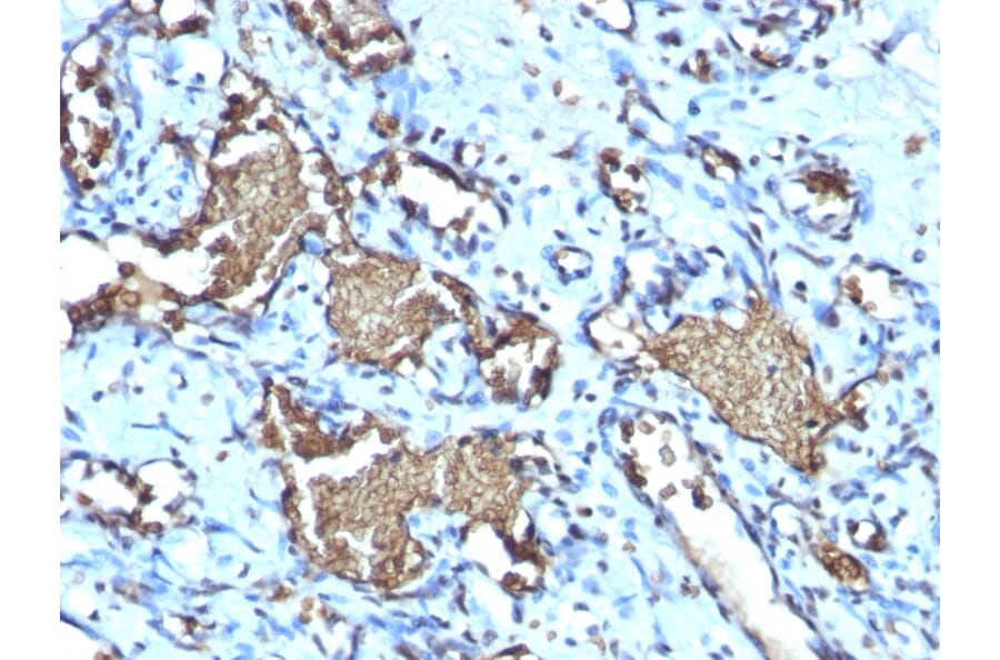 Immunohistochemistry - Anti-Glycophorin A Antibody [GYPA/1725R] - BSA and Azide free (A251972) - Antibodies.com
