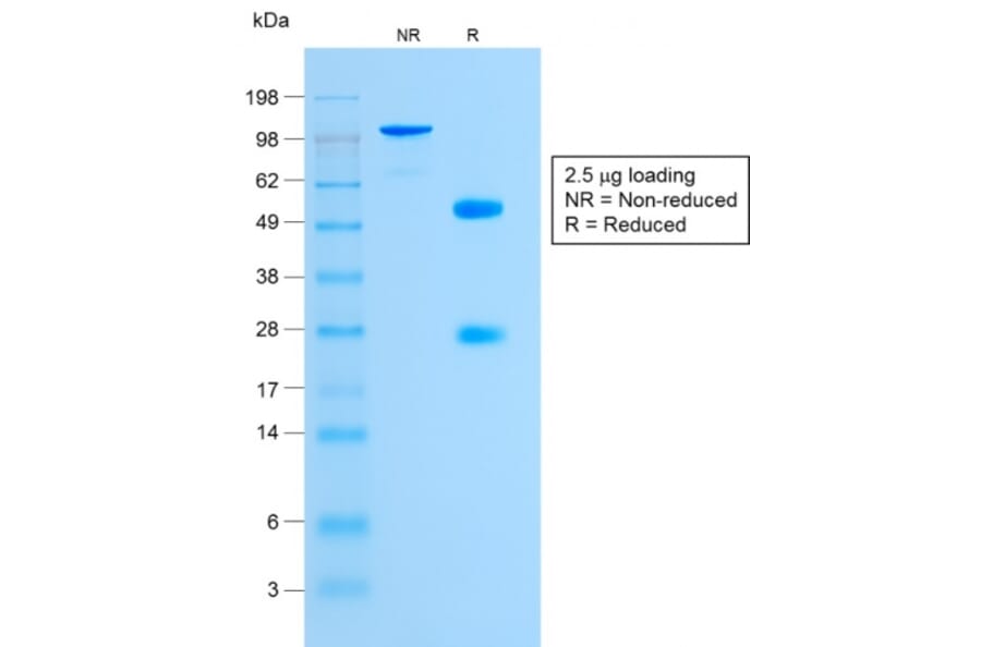 SDS-PAGE - Anti-Glycophorin A Antibody [GYPA/1725R] - BSA and Azide free (A251973) - Antibodies.com