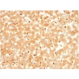 Immunohistochemistry - Anti-alpha 2 Macroglobulin Antibody [A2M/3621] - BSA and Azide free (A251976) - Antibodies.com
