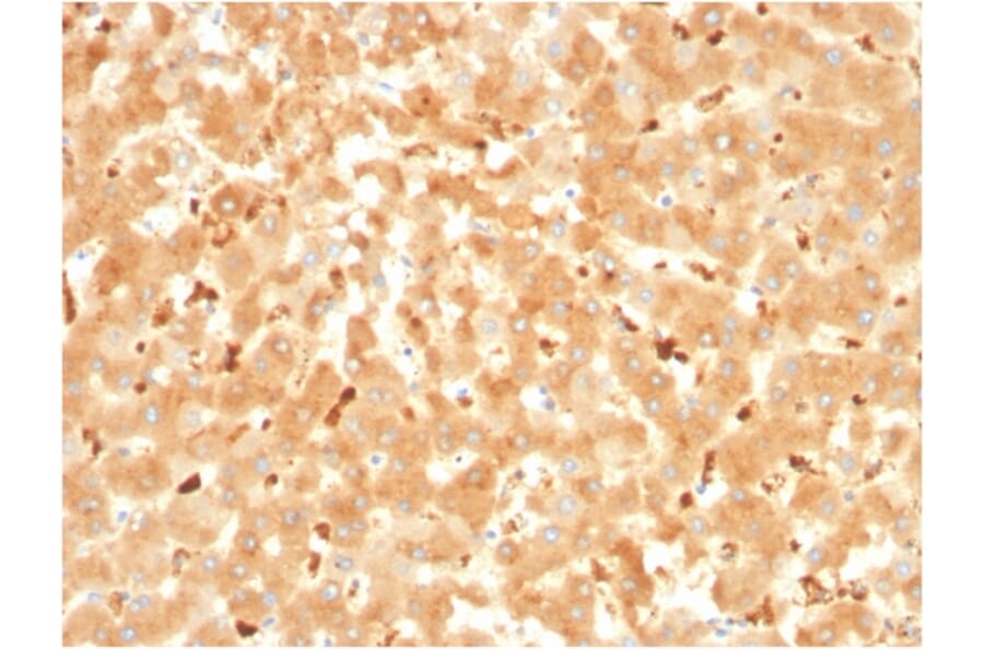Immunohistochemistry - Anti-alpha 2 Macroglobulin Antibody [A2M/3621] - BSA and Azide free (A251975) - Antibodies.com