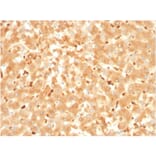 Immunohistochemistry - Anti-alpha 2 Macroglobulin Antibody [A2M/3621] - BSA and Azide free (A251975) - Antibodies.com