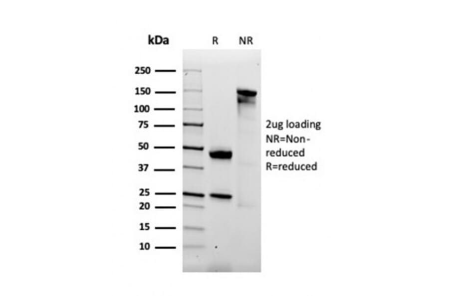 SDS-PAGE - Anti-alpha 2 Macroglobulin Antibody [A2M/3621] - BSA and Azide free (A251976) - Antibodies.com