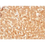 Immunohistochemistry - Anti-alpha 2 Macroglobulin Antibody [A2M/3623] - BSA and Azide free (A251977) - Antibodies.com