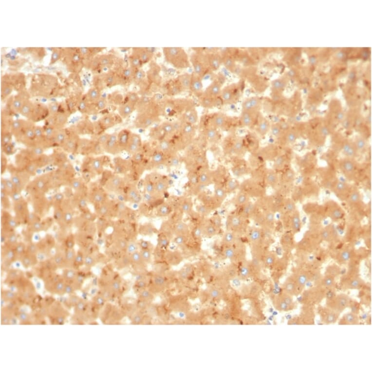 Immunohistochemistry - Anti-alpha 2 Macroglobulin Antibody [A2M/3623] - BSA and Azide free (A251977) - Antibodies.com