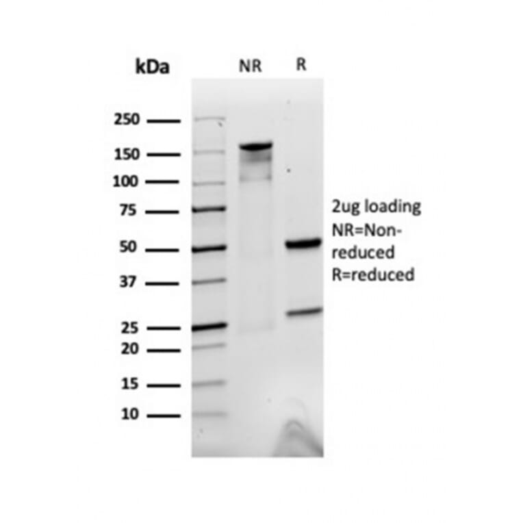SDS-PAGE - Anti-alpha 2 Macroglobulin Antibody [A2M/3623] - BSA and Azide free (A251977) - Antibodies.com