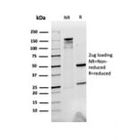 SDS-PAGE - Anti-alpha 2 Macroglobulin Antibody [A2M/3623] - BSA and Azide free (A251977) - Antibodies.com