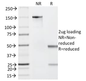 SDS-PAGE - Anti-Granzyme B Antibody [GZMB/2403] - BSA and Azide free (A251978) - Antibodies.com