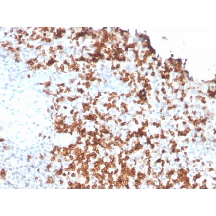 Immunohistochemistry - Anti-Granzyme B Antibody [GZMB/3056] - BSA and Azide free (A251981) - Antibodies.com