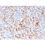 Immunohistochemistry - Anti-Granzyme B Antibody [GZMB/3056] - BSA and Azide free (A251981) - Antibodies.com