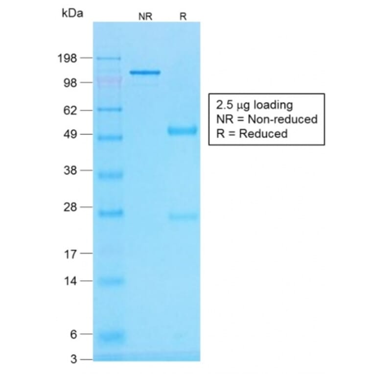 SDS-PAGE - Anti-Histone H1 Antibody [r1415-1] - BSA and Azide free (A251986) - Antibodies.com