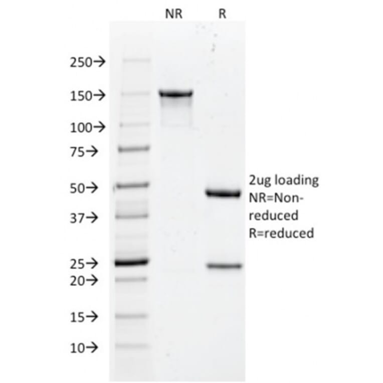 SDS-PAGE - Anti-Histone H1 Antibody [rAE-4] - BSA and Azide free (A251987) - Antibodies.com