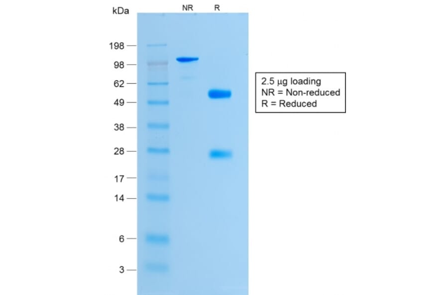 SDS-PAGE - Anti-Histone H1 Antibody [HH1/1784R] - BSA and Azide free (A251988) - Antibodies.com