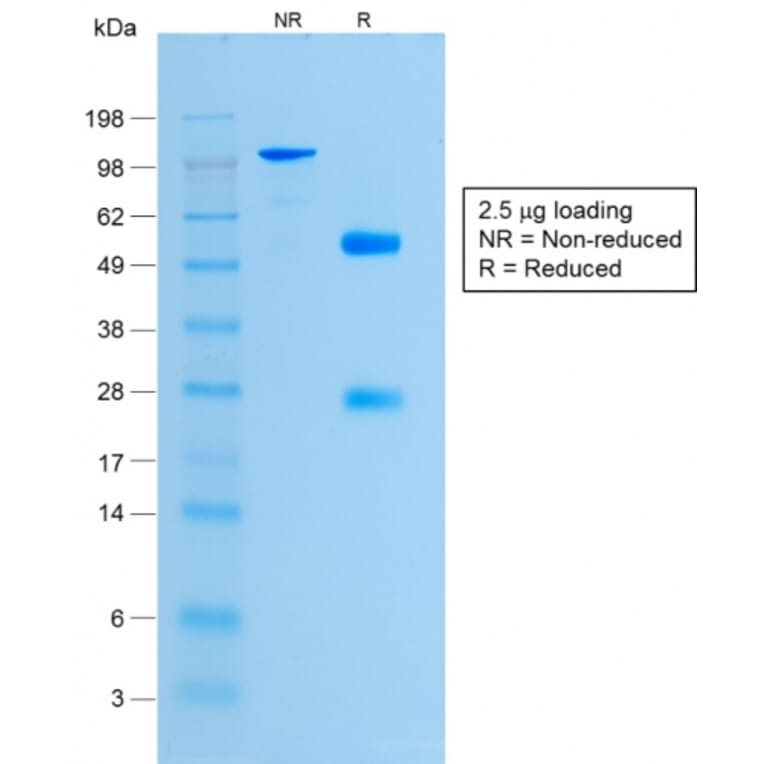 SDS-PAGE - Anti-Histone H1 Antibody [HH1/1784R] - BSA and Azide free (A251988) - Antibodies.com