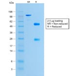 SDS-PAGE - Anti-Histone H1 Antibody [HH1/1784R] - BSA and Azide free (A251988) - Antibodies.com