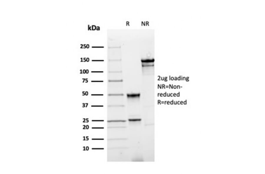 SDS-PAGE - Anti-Annexin A1 Antibody [rANXA1/4310] - BSA and Azide free (A251991) - Antibodies.com