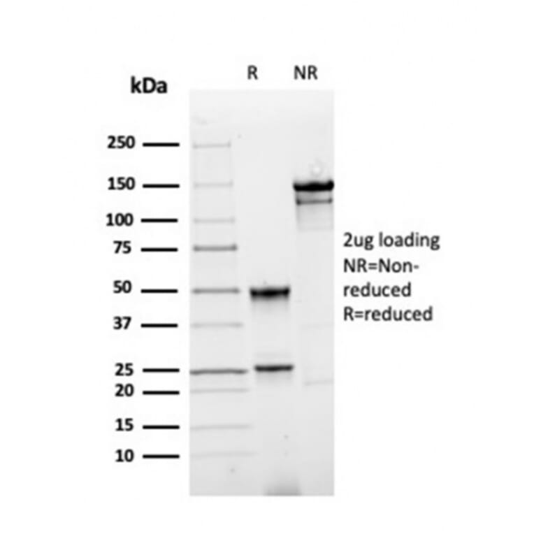 SDS-PAGE - Anti-Annexin A1 Antibody [rANXA1/4310] - BSA and Azide free (A251991) - Antibodies.com