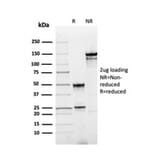 SDS-PAGE - Anti-Annexin A1 Antibody [rANXA1/4310] - BSA and Azide free (A251991) - Antibodies.com