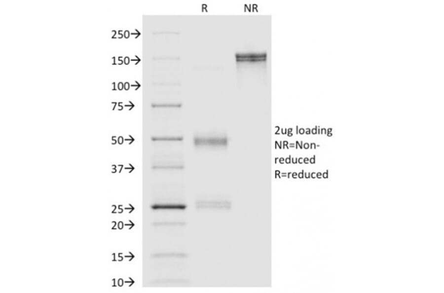 SDS-PAGE - Anti-Annexin A1 Antibody [ANXA1/1671] - BSA and Azide free (A251992) - Antibodies.com